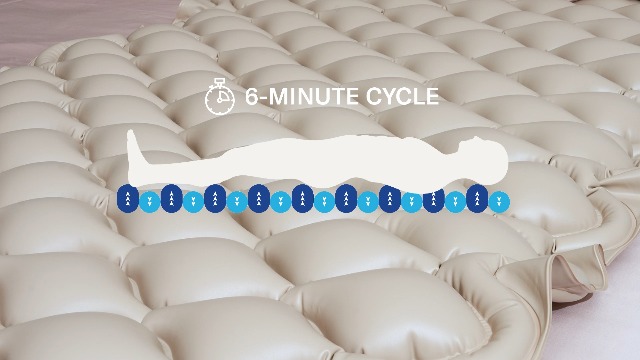 Alternating Pressure Mattress by Alcedo Health